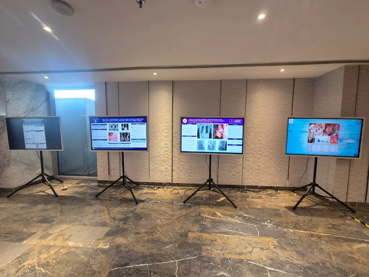 Four LED TVs on floor stands set up for an event